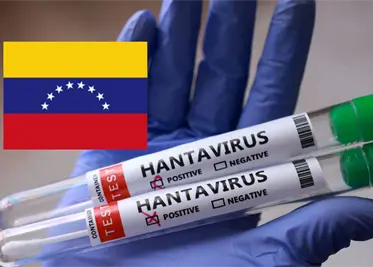 alerta por hantavirus en venezuela reportan tres muertos y dos mas bajo investigacion 0b22bbf1 focus 0 0 373 267